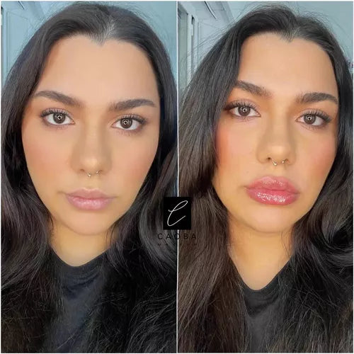 VOLUMINIZADOR DE LABIOS KISS BEAUTY